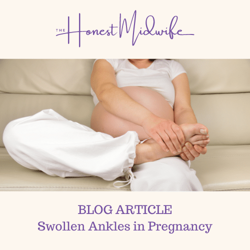 Swollen ankles in pregnancy